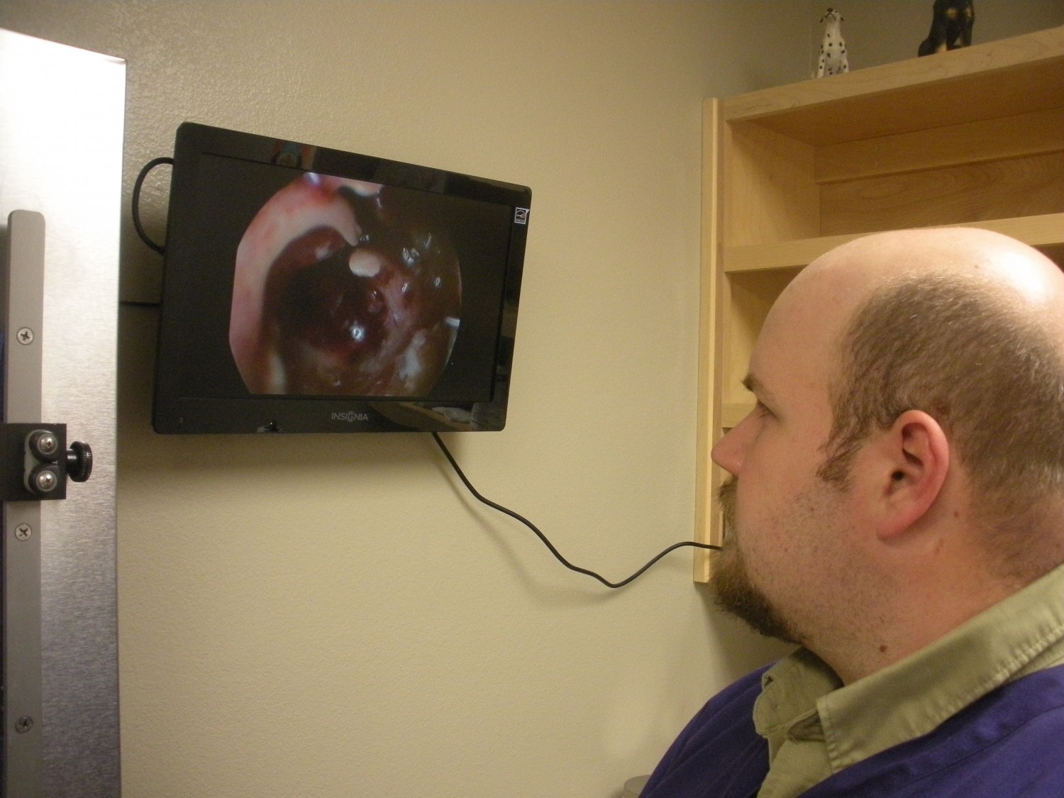 Video Otoscopy